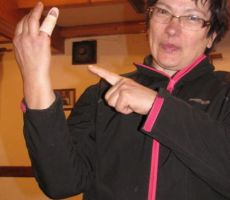 Milena pa je imela manj sreče in je med tem časo poskrbela za izpahnjeni mezinec...